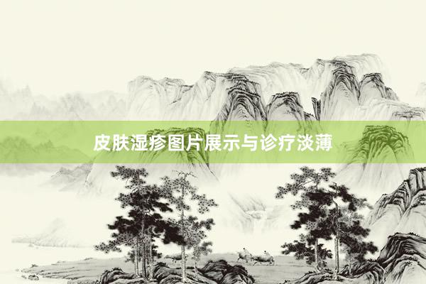 皮肤湿疹图片展示与诊疗淡薄